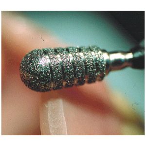 Electroplated spiral diamond finishers - Turbo Diamond Grinders -shape 237-3368